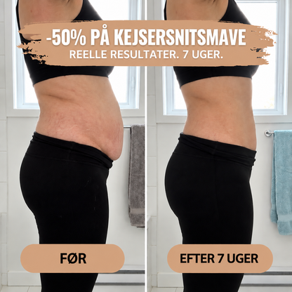 The Women™ Barselstrusser – 360° Formende Støtte